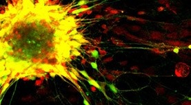 motor-control-neuron motor-control-neuron